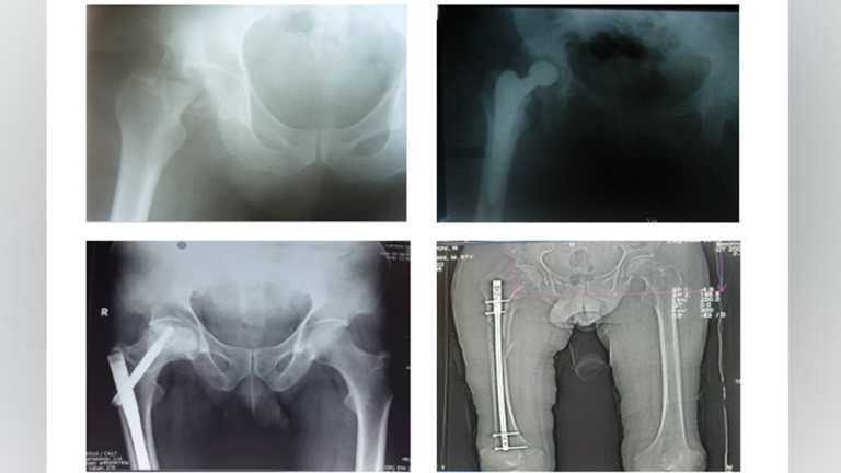 image-18